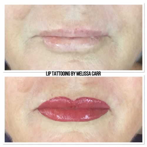 Lip-Tattooing-Auckland-Melissa-Carr-Cosmetic-Tattooing